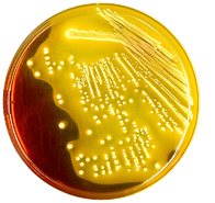 Petrischale mit golden gefärbtem Nährmedium und zahlreichen Bakterienkulturen (Bewuchs auf den Ausstrichen)