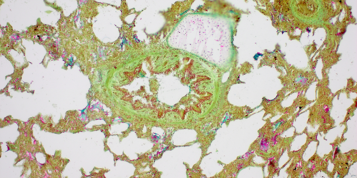 Mikroskopische Ansicht von verschieden gefärbten Gewebeteilen