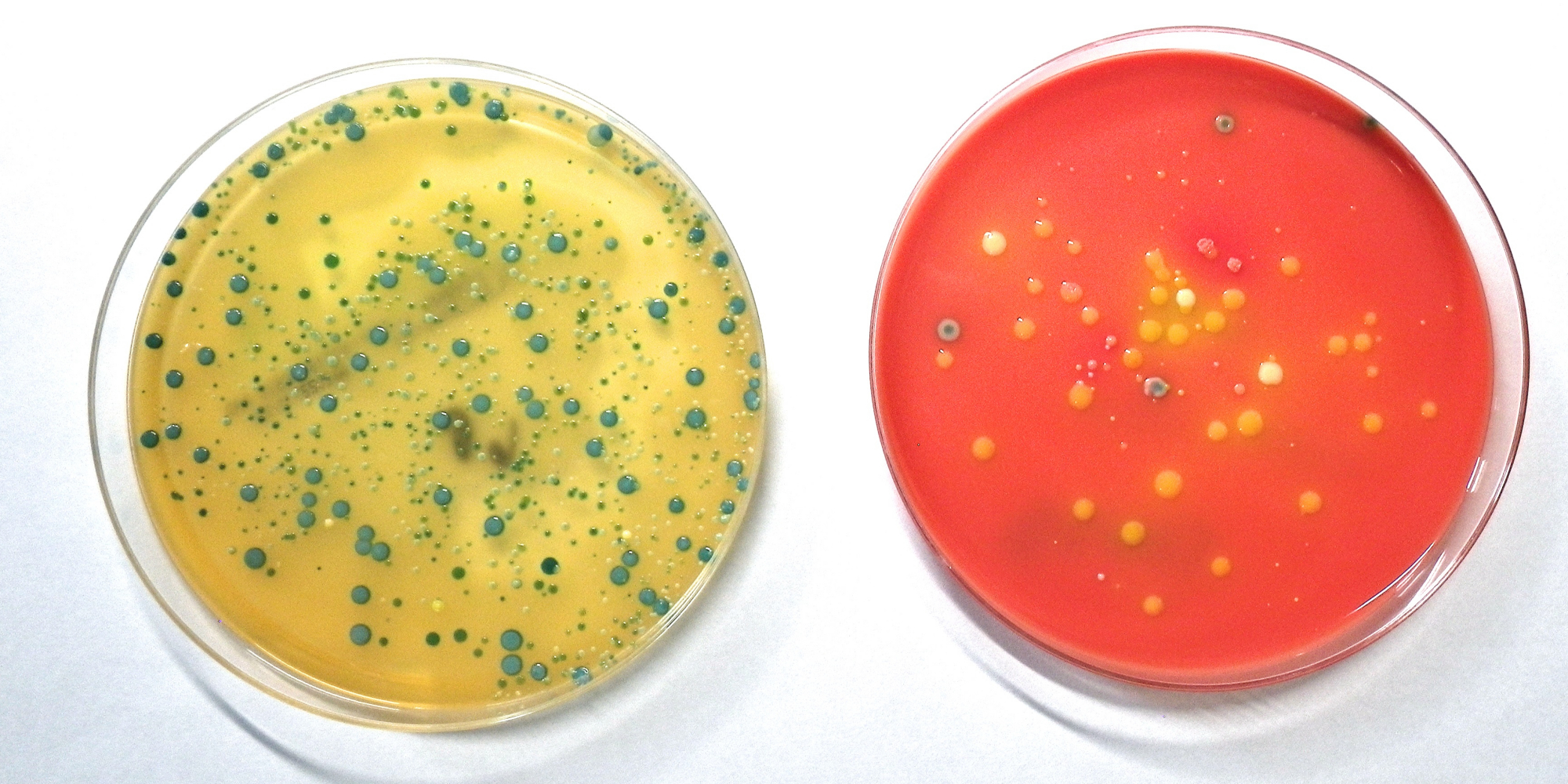 eine Platte mit einem gelben Nährmedium und bläulichen Kolonien, eine mit einem roten Nährmedium und geblichen und bläulichen Kolonien