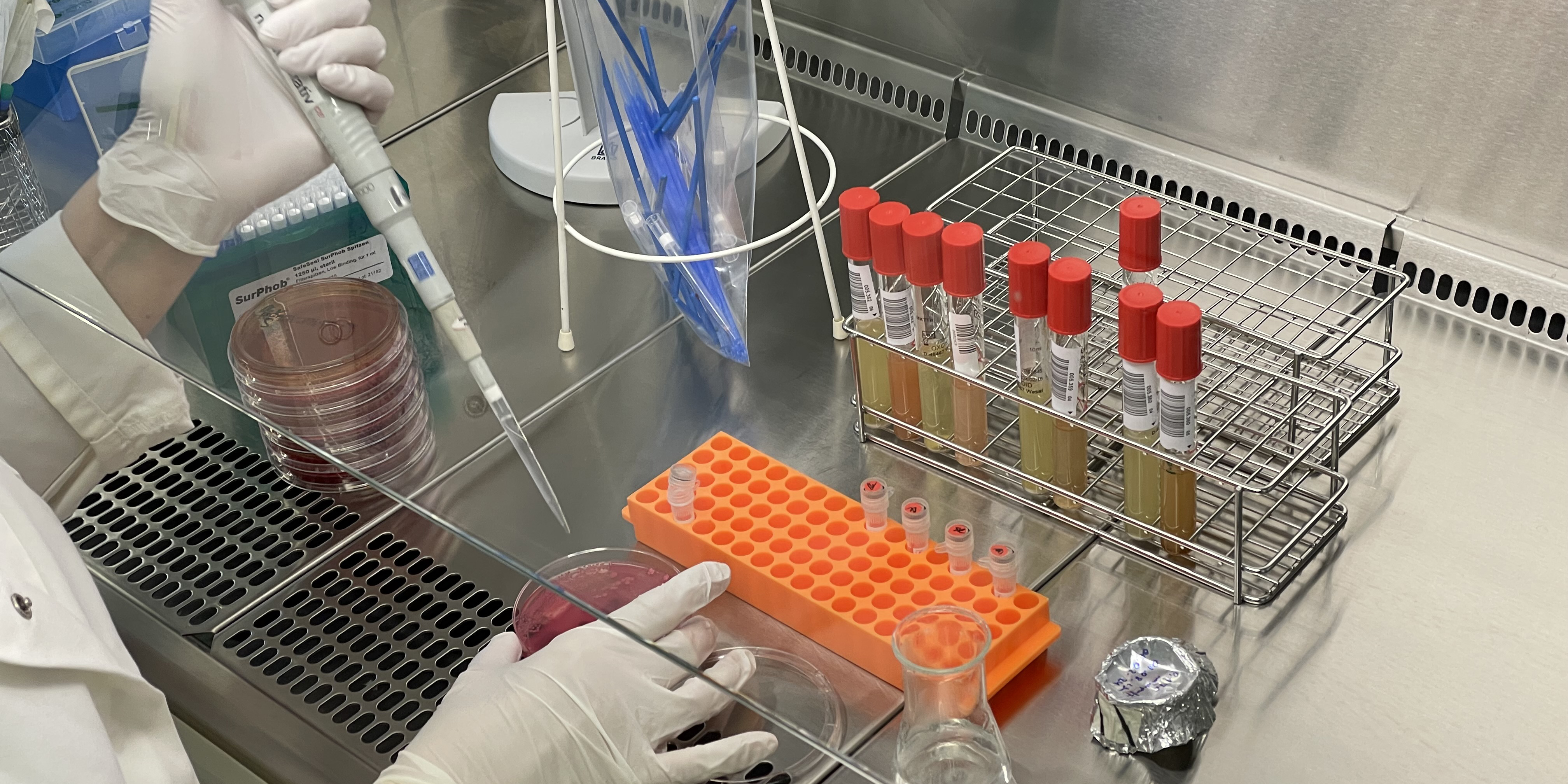Bild: Mit Gummihandschuhen geschützte Hände pipettieren Probenflüssigkeit auf ein Nährmedium in einer Petrischale. In einem Ständer stehen weitere Proben, gebrauchte Pipettenspitzen werden in einem Abfallbehälter gesammelt.