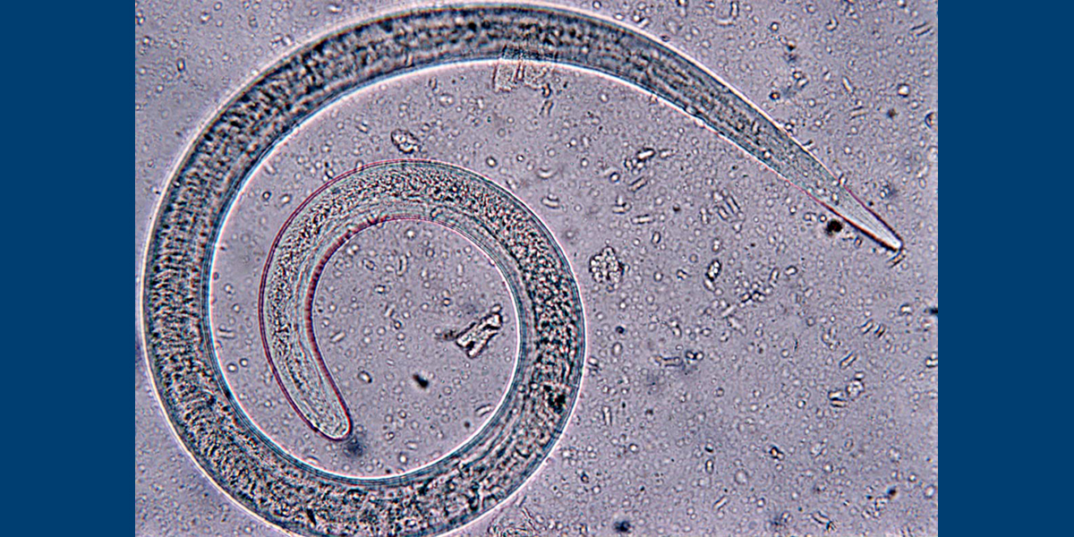 Bild: Mikroskopische Aufnahme eines Trichins (Fadenwurm der Gattung Trichinella)